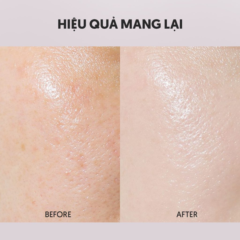 DÙNG RETINOL ĐÚNG CÁCH